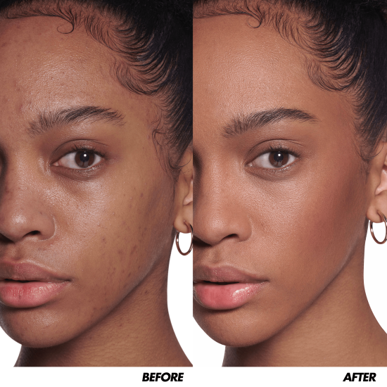 hdskin_pal h2 before&after 1